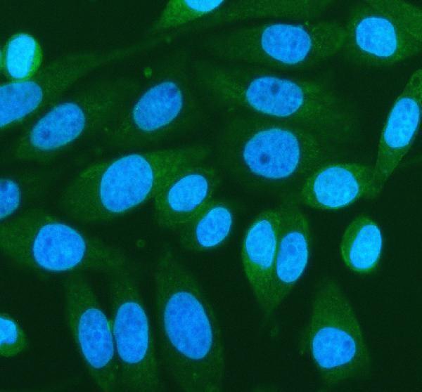 a04056 2 prkd2 primary antibodies if testing 1