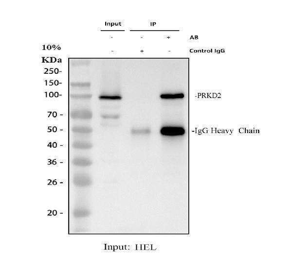 a04056 2 prkd2 primary antibodies ip testing 1