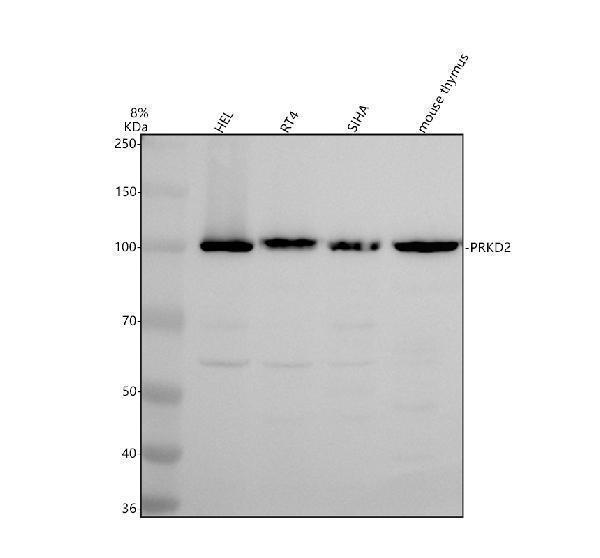 a04056 2 prkd2 primary antibodies wb testing 1