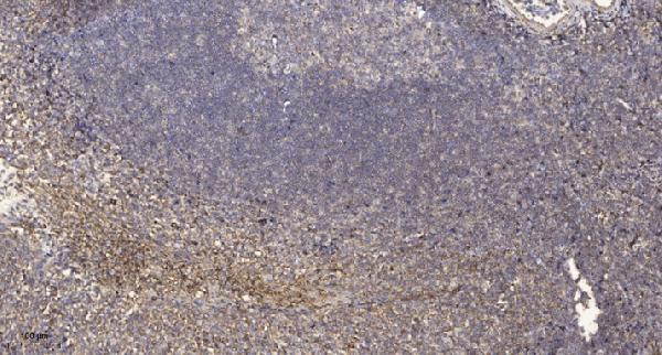 a04056s876 1 prkd2 primary antibodies ihc testing 5