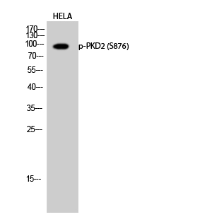 a04056s876 1 prkd2 primary antibodies wb testing 3
