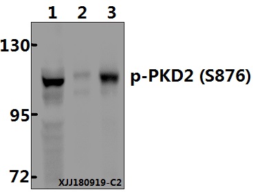 a04056s876 prkd2 primary antiboties wb testing 1