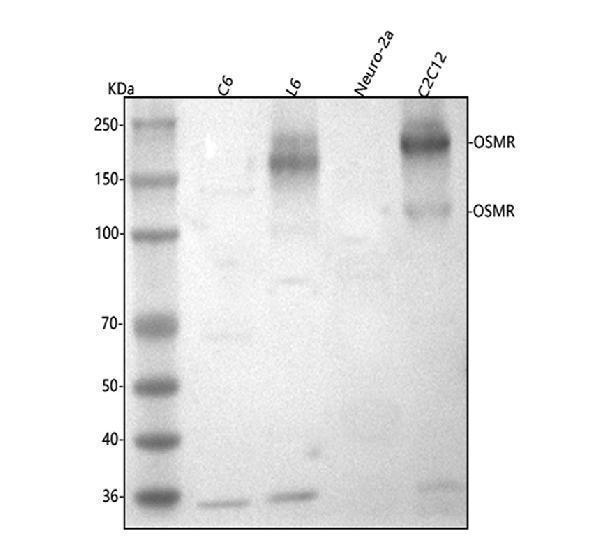  Western blot analysis of Osmr using anti-Osmr antibody (A04061-2)