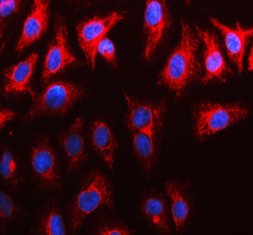a04063 1 ca12 primary antibodies if testing 1