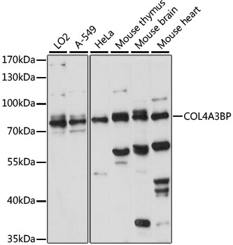 a04064 col4a3bp primary antiboties wb testing 1