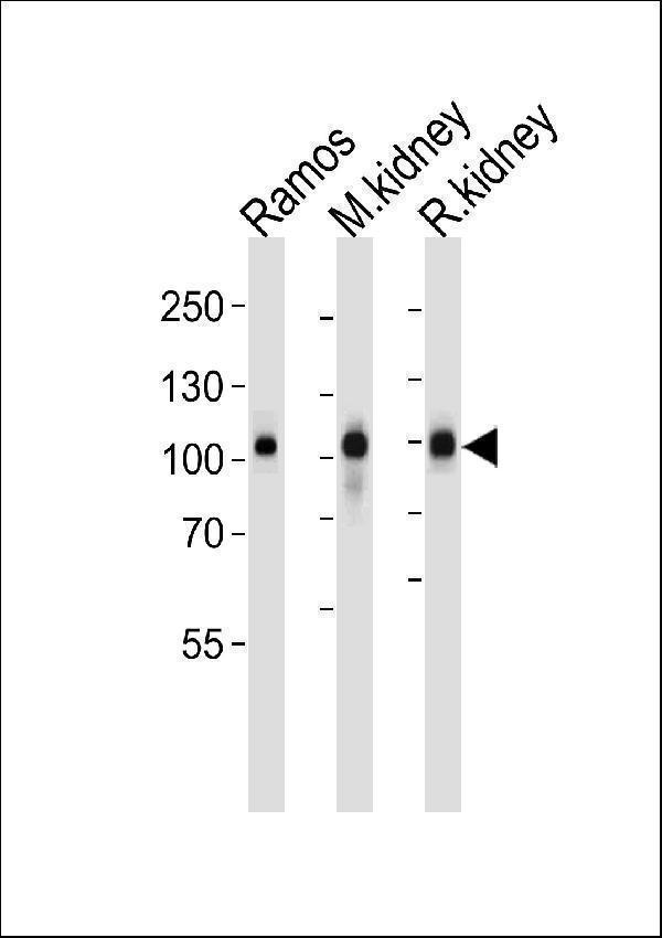 Western blot analysis of lysates from Ramos cell line,mouse kidney and rat kidney tissue (from left to right),using Neprilysin Antibody (Center) (Cat