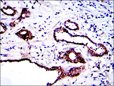 Immunohistochemistry analysis of paraffin-embedded prostate tissues with DAB staining using PRK2 Monoclonal Antibody