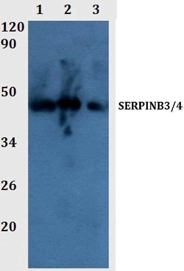 Western blot (WB) analysis of SERPINB3/4 polyclonal antibody at 1:500 dilution 
Line1:THP-1 whole cell lysate
Line2:PC12 whole cell lysate
Line3:sp20 whole cell lysate