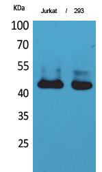 Western Blot analysis of Jurkat, 293 cells using SCCA1/2 Polyclonal Antibody