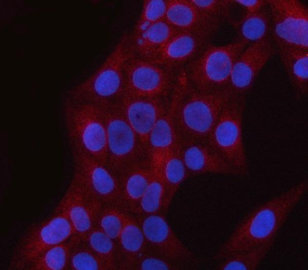  IF analysis of PNPLA6 using anti-PNPLA6 antibody (A04071-2)