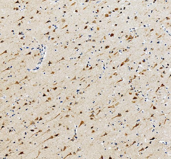 IHC analysis of PNPLA6 using anti-PNPLA6 antibody (A04071-2)