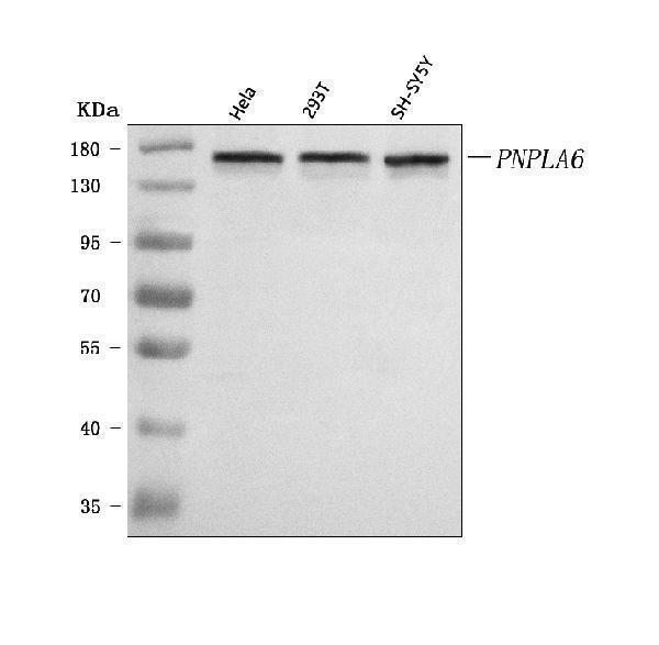  Western blot analysis of PNPLA6 using anti-PNPLA6 antibody (A04071-2)