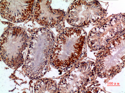 a04071 pnpla6 primary antibodies ihc testing 4