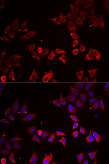 Immunofluorescence analysis of MCF7 cells using LIMS1 antibody 