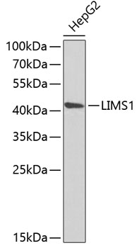 Western blot analysis of extracts of HepG2 cells, using LIMS1 antibody  at 1:1000 dilution