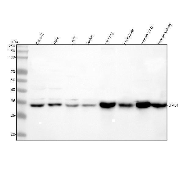  Western blot analysis of LIMS1 using anti-LIMS1 antibody (A04072-2)