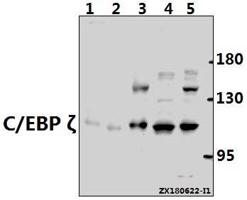 Western blot (WB) analysis of C/EBP ζ (D24) pAb at 1:500 dilution
Lane1:PC12 whole cell lysate(40ug)
Lane2:3T3-L1 whole cell lysate(40ug)
Lane3:A2780 whole cell lysate(40ug)
Lane4:Hela whole cell lysate(40ug)
Lane5:MCF-7 whole cell lysate(40ug)