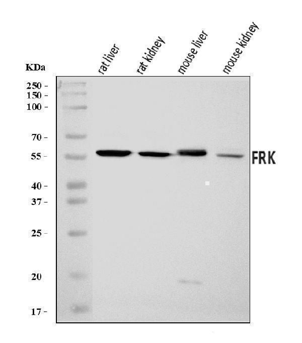  Western blot analysis of FRK using anti-FRK antibody (A04075-1)