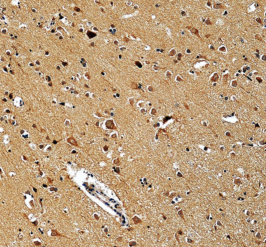 a04076 2 kalrn primary antibodies ihc testing 1