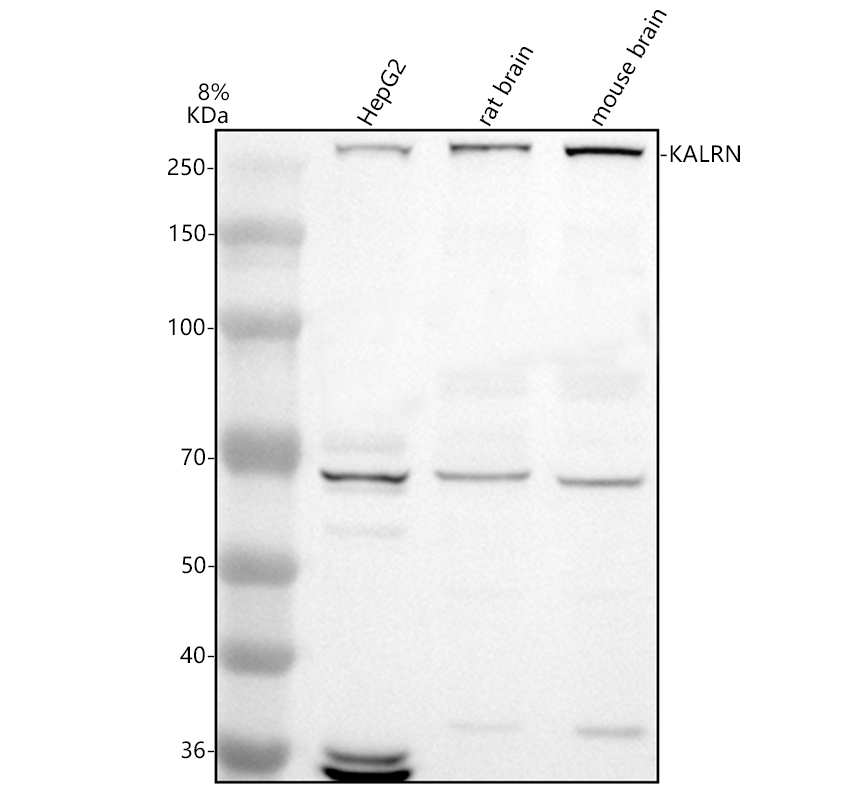 a04076 2 kalrn primary antibodies wb testing 1