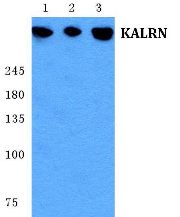 Western blot (WB) analysis of GPR15 pAb at 1:500 dilution
Lane1:Hela whole cell lysate(40ug)
Lane2:SGC7901 whole cell lysate(40ug)
Lane3:HEK293T whole cell lysate(40ug)
Lane4:The Uterus tissue lysate of Mouse(40ug)
Lane5:The Uterus tissue lysate of Rat(40ug)