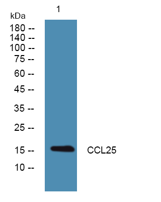 Western blot analysis of lysates from HCT116 cells, primary antibody was diluted at 1:1000, 4°over night
