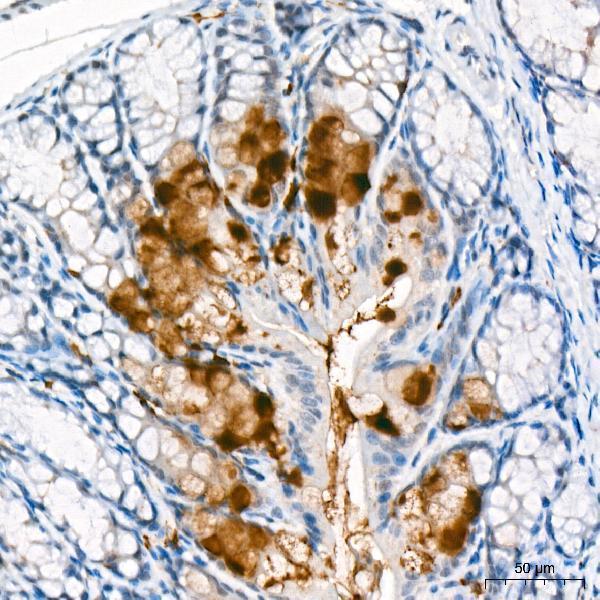 Immunohistochemistry analysis of CCL25 in paraffin-embedded Mouse large intestine tissue using CCL25 pAb at a dilution of 1:300 (40x lens)