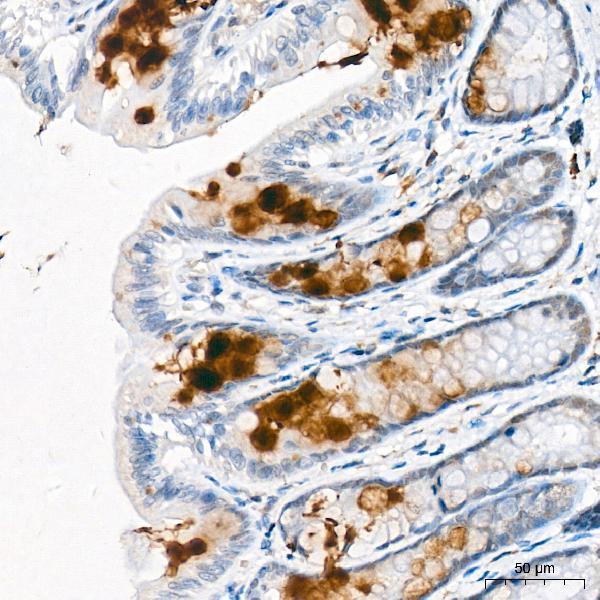 Immunohistochemistry analysis of CCL25 in paraffin-embedded Rat large intestine tissue using CCL25 pAb at a dilution of  1:300 (40x lens)