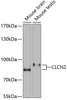 Western blot analysis of extracts of various cell lines, using CLCN2 Antibody  at 1:1000 dilution