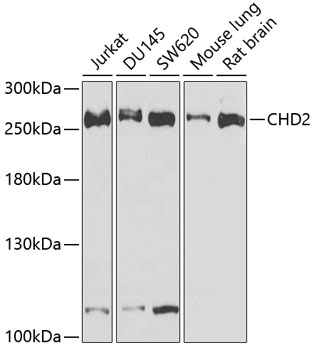 Western blot analysis of extracts of various cell lines, using CHD2 antibody  at 1:1000 dilution