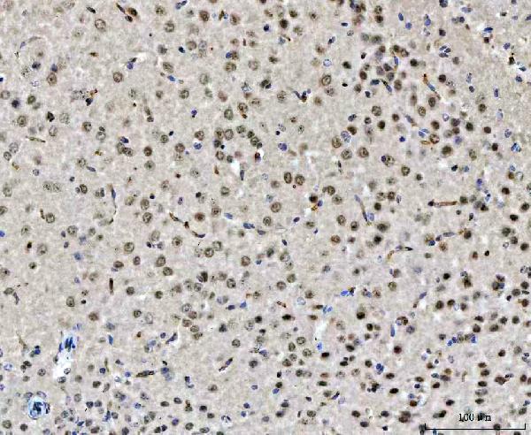 a04079 chd2 primary antibodies ihc testing 3