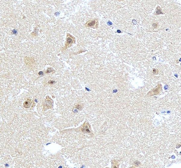 a04079 chd2 primary antibodies ihc testing 4