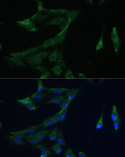 Immunofluorescence analysis of C6 cells using ARL3 Polyclonal Antibody  at dilution of 1:100 