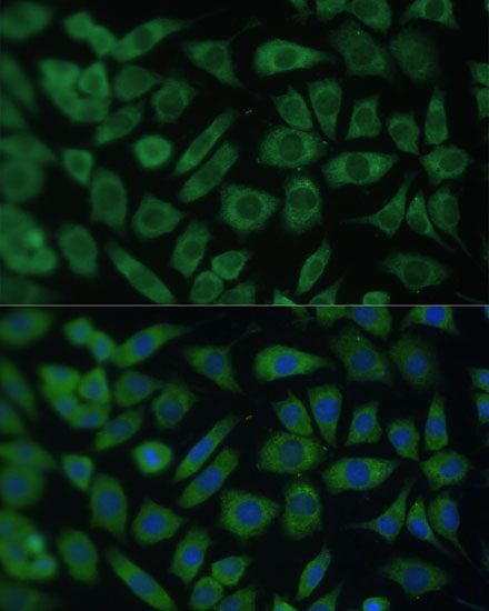 Immunofluorescence analysis of L929 cells using ARL3 Polyclonal Antibody  at dilution of 1:100 