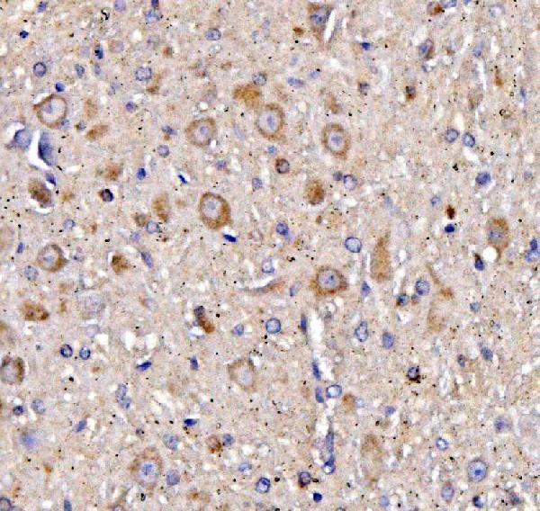 a04081 chrm1 primary antibodies ihc testing 2
