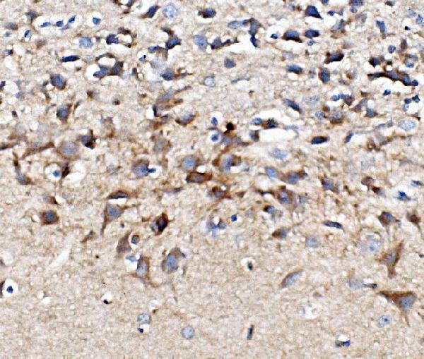 a04081 chrm1 primary antibodies ihc testing 3