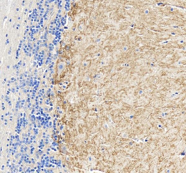 a04081 chrm1 primary antibodies ihc testing 4