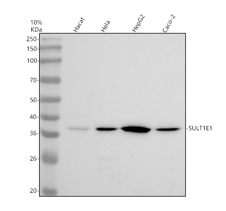 Western blot analysis of SULT1E1 using anti-SULT1E1 antibody (A04082-2)