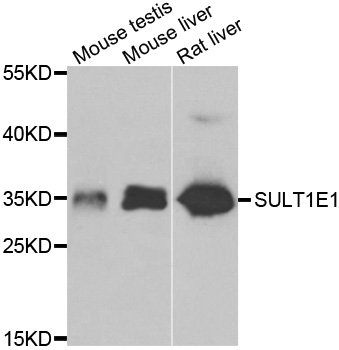 Western blot analysis of extracts of various cell lines, using SULT1E1 antibody