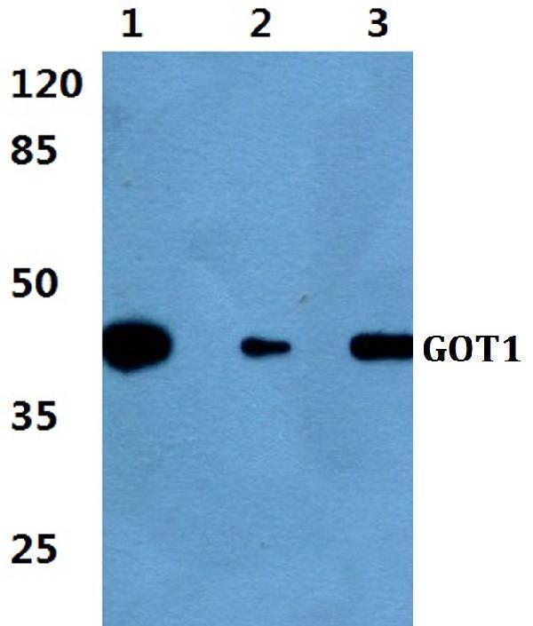 a04085 1 got1 primary antiboties wb testing 1