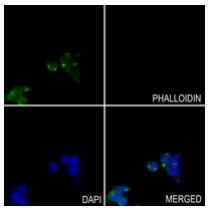 a04085 2 got1 primary antiboties if testing 3