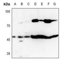 a04085 2 got1 primary antiboties wb testing 1
