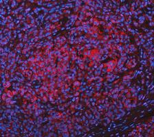 a04085 3 got1 primary antibodies if testing 3
