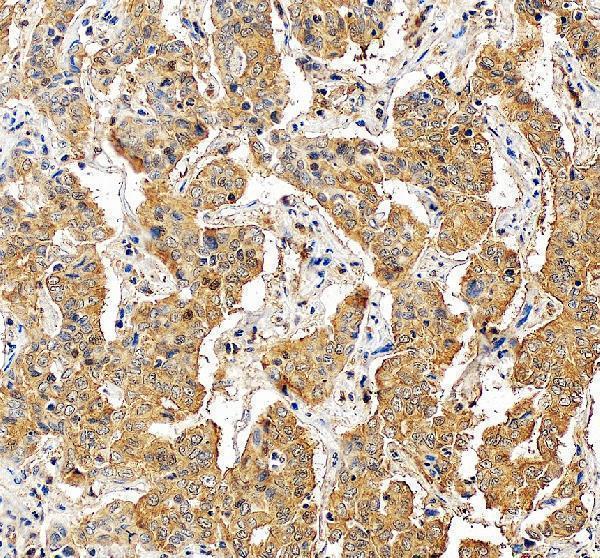IHC analysis of Aspartate Aminotransferase/GOT1 using anti-Aspartate Aminotransferase/GOT1 antibody (A04085-3)