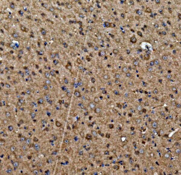 a04085 3 got1 primary antibodies ihc testing 2