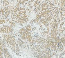 a04085 3 got1 primary antibodies ihc testing 3