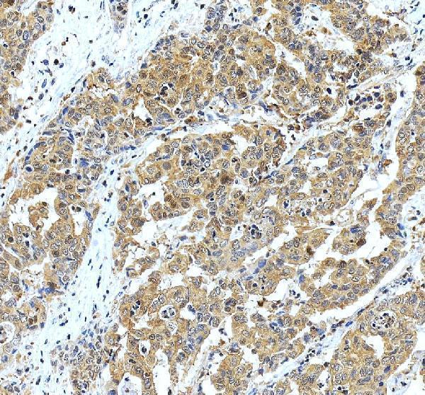 IHC analysis of GOT1 using anti-GOT1 antibody (A04085-3)