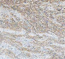 a04085 3 got1 primary antibodies ihc testing 4