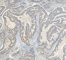 a04085 3 got1 primary antibodies ihc testing 5