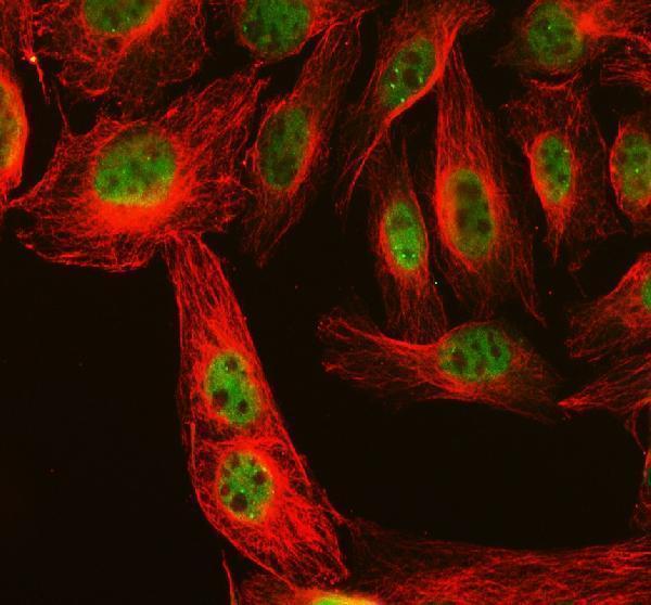 a04086 2 fbxo7 primary antibodies if testing 5
